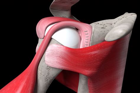 shoulder labrum tear test recovery